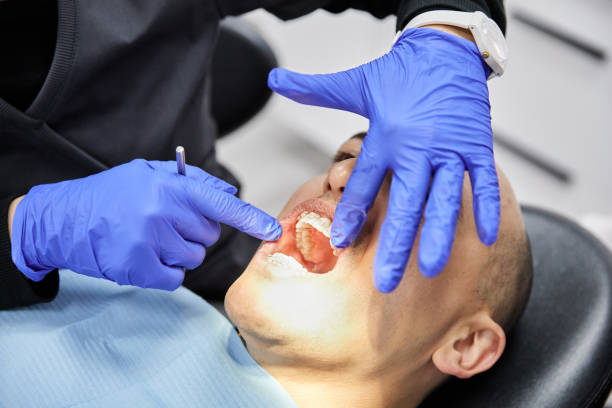 Best Emergency Treatment for Oral Infections in Brisbane, CA