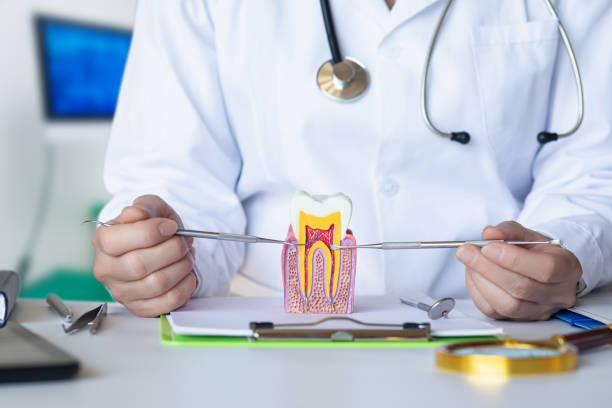 Best Knocked-Out Tooth (Avulsed Tooth) Treatment in Brisbane, CA